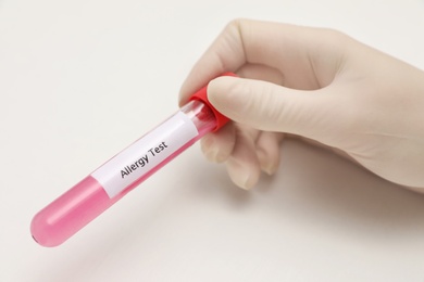 Doctor holding tube with label ALLERGY TEST on light background, closeup