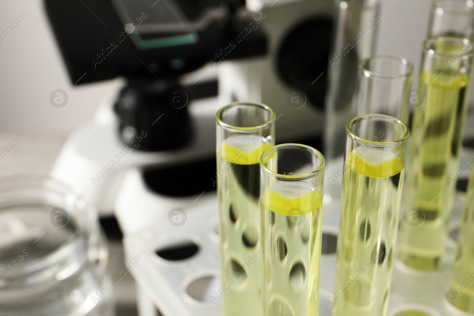 Photo of Test tubes with urine samples for analysis in holder near microscope, closeup