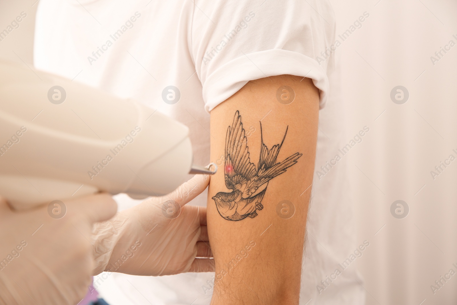 Photo of Young man undergoing laser tattoo removal procedure in salon, closeup