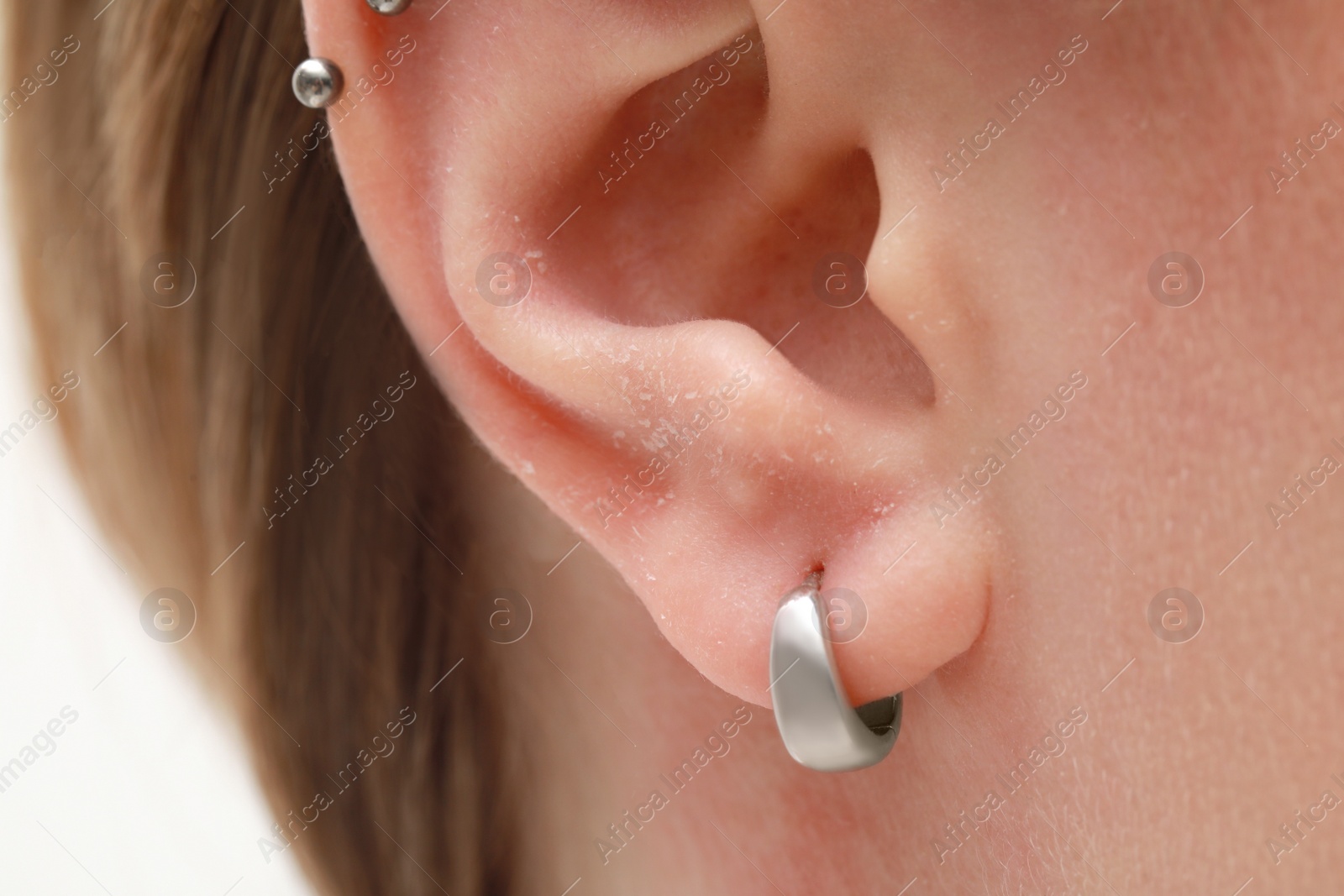 Photo of Woman with dry skin on white background, closeup of ear