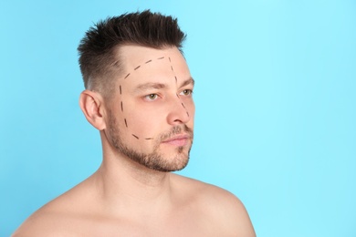 Photo of Man with marks on face for cosmetic surgery operation against blue background. Space for text