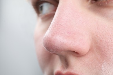 Photo of Woman with dry skin on nose against light background, closeup