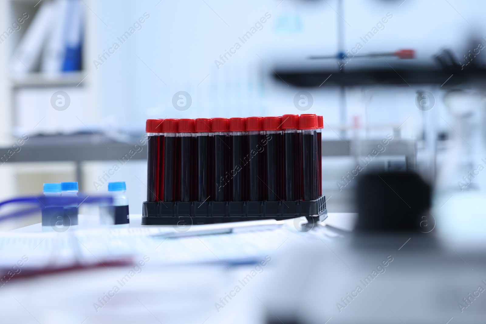 Photo of Test tubes with samples on table in laboratory