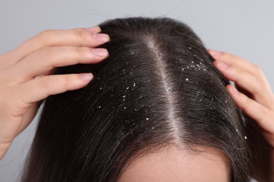 Woman with dandruff problem on grey background, closeup