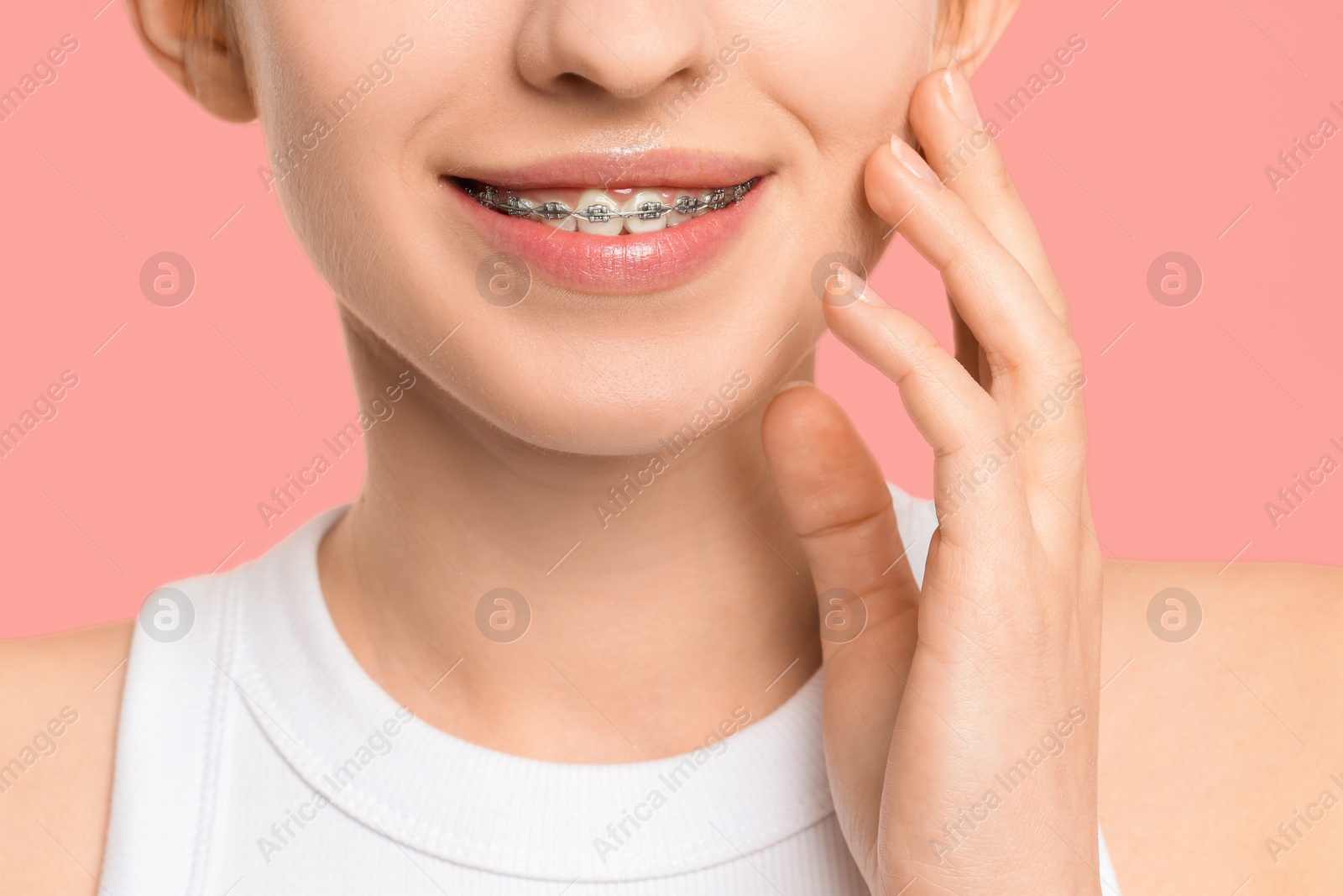 Photo of Smiling woman with dental braces on pink background, closeup