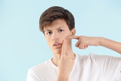 Teenage boy with acne problem on light background