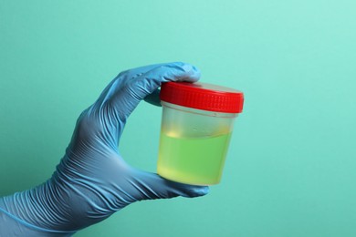Photo of Doctor holding container with urine sample for analysis on turquoise background, closeup