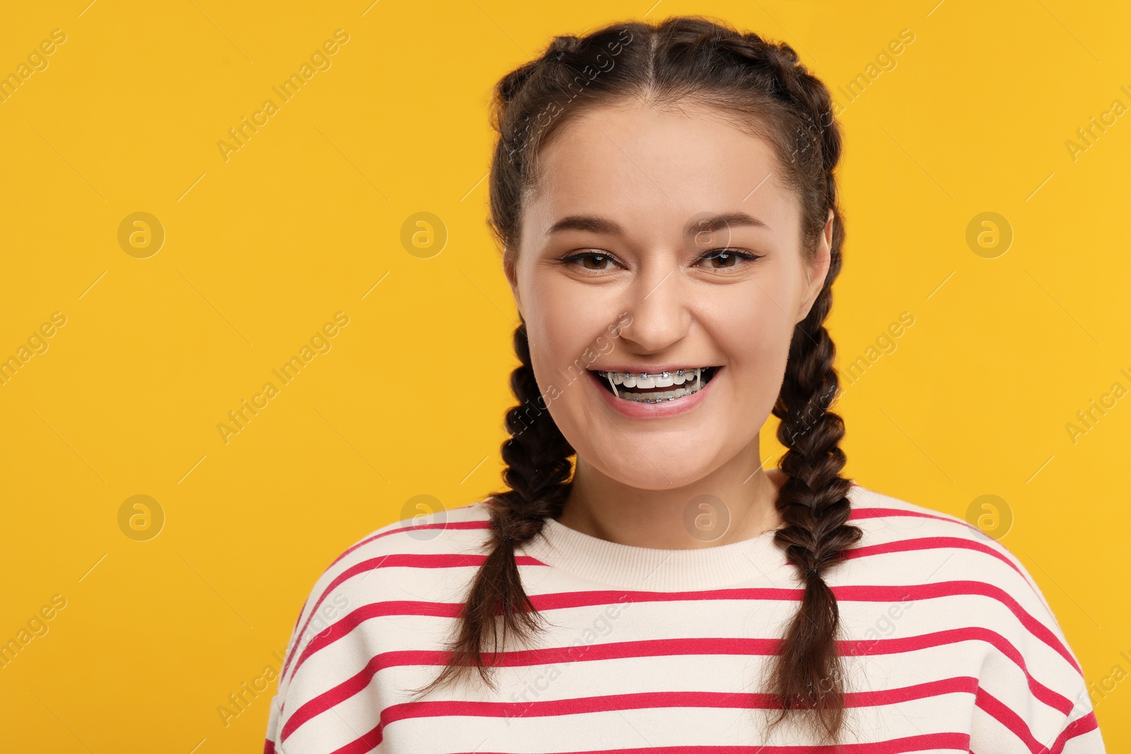 Photo of Smiling woman with dental braces and orthodontic elastics on orange background. Space for text