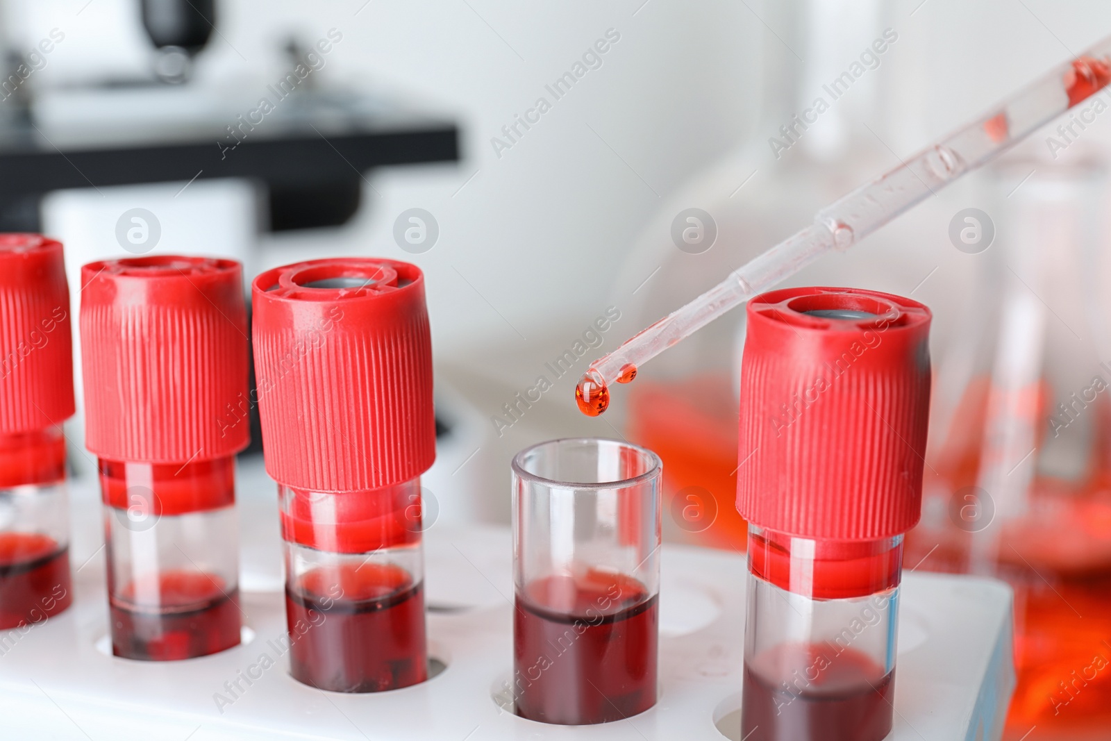 Image of Dripping sample from pipette into test tube, closeup. Laboratory analysis