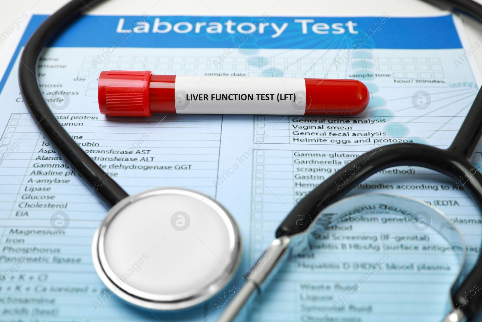 Photo of Liver Function Test. Tube with blood sample, form and stethoscope on table, closeup