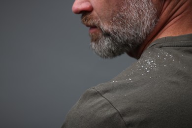 Photo of Bearded man with dandruff on his t-shirt against grey background, closeup. Space for text