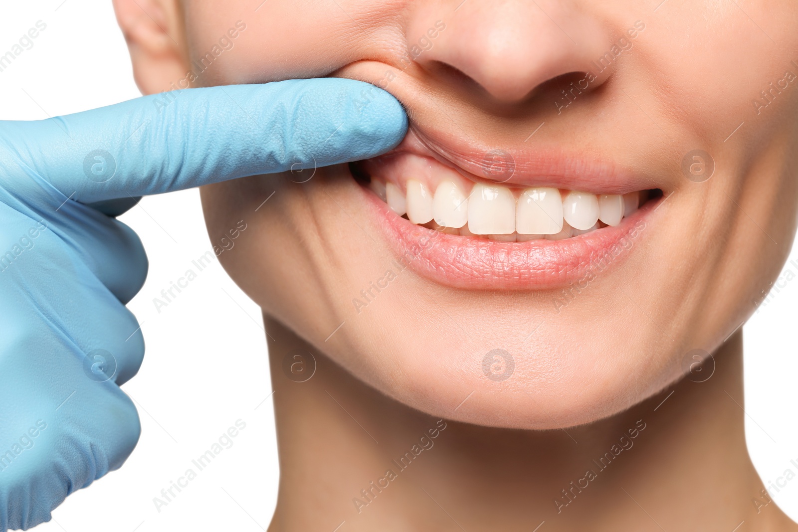 Photo of Doctor examining woman's gums on light background, closeup