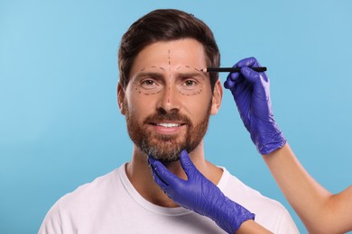 Photo of Doctor drawing marks on man's face for cosmetic surgery operation against light blue background