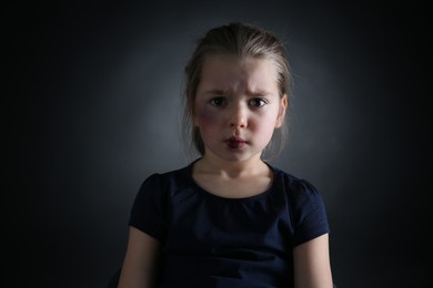 Photo of Little girl with bruises on face against dark background. Domestic violence victim