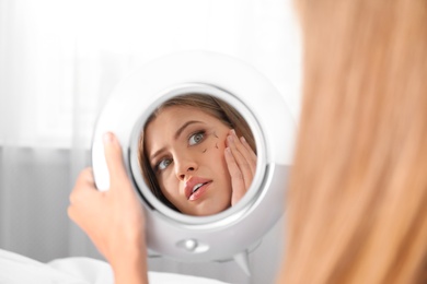 Photo of Young woman with eyelash loss problem looking in mirror indoors