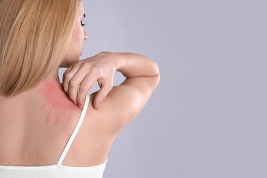 Woman with allergy symptoms scratching shoulder on grey background, closeup. Space for text