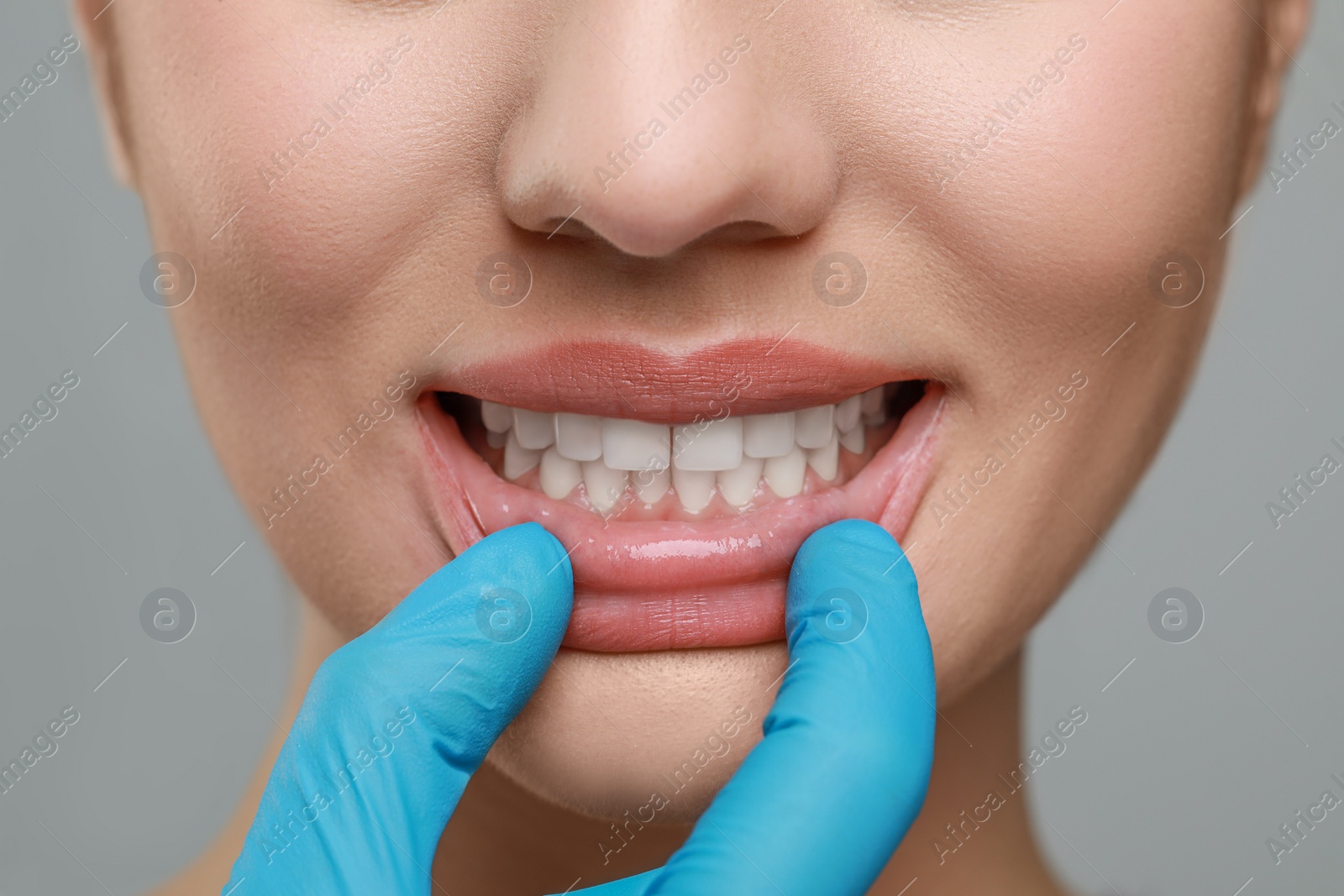 Photo of Doctor examining woman's gums on grey background, closeup