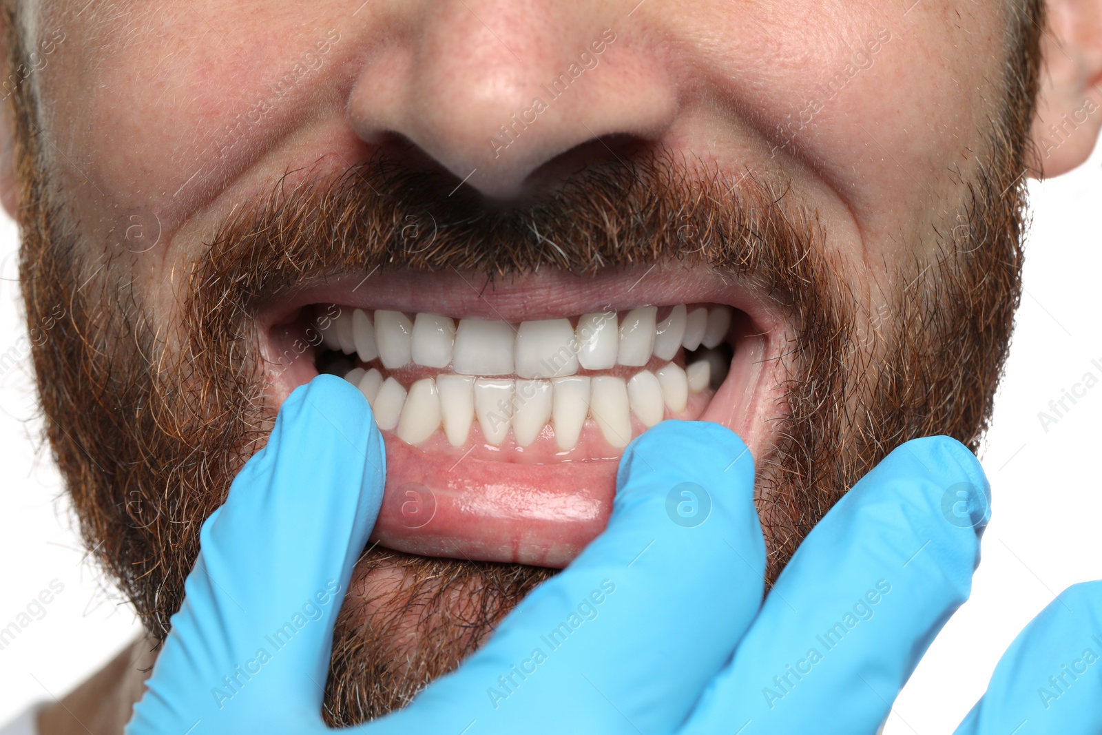 Photo of Man showing healthy gums on white background, closeup