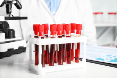 Photo of Test tubes with blood samples on table in laboratory. Virus research