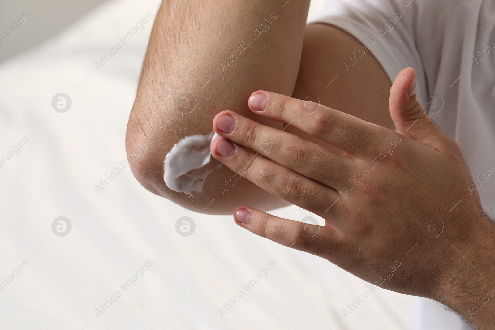 Photo of Man with dry skin applying cream onto his elbow on light background, closeup