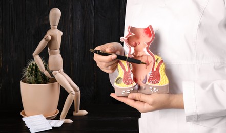Doctor pointing at model of rectum with hemorrhoid, closeup. Wooden human figure, cactus and suppositories on black table