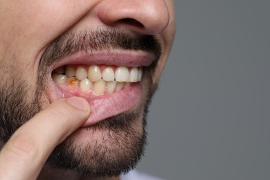 Man showing gums on gray background, closeup. Space for text