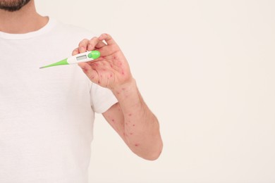 Man with rash holding thermometer on beige background, space for text. Monkeypox virus diagnosis