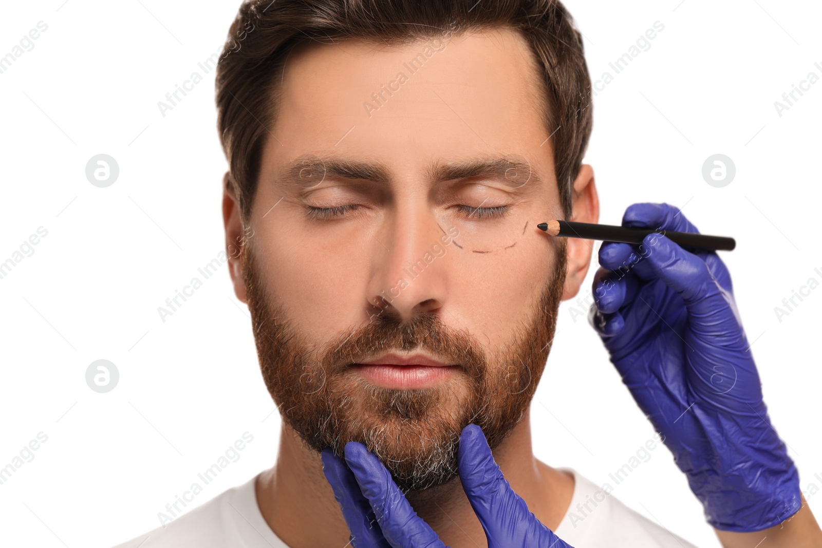 Photo of Doctor with pencil preparing patient for cosmetic surgery operation on white background, closeup