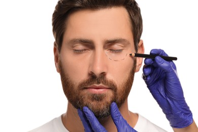 Photo of Doctor with pencil preparing patient for cosmetic surgery operation on white background, closeup