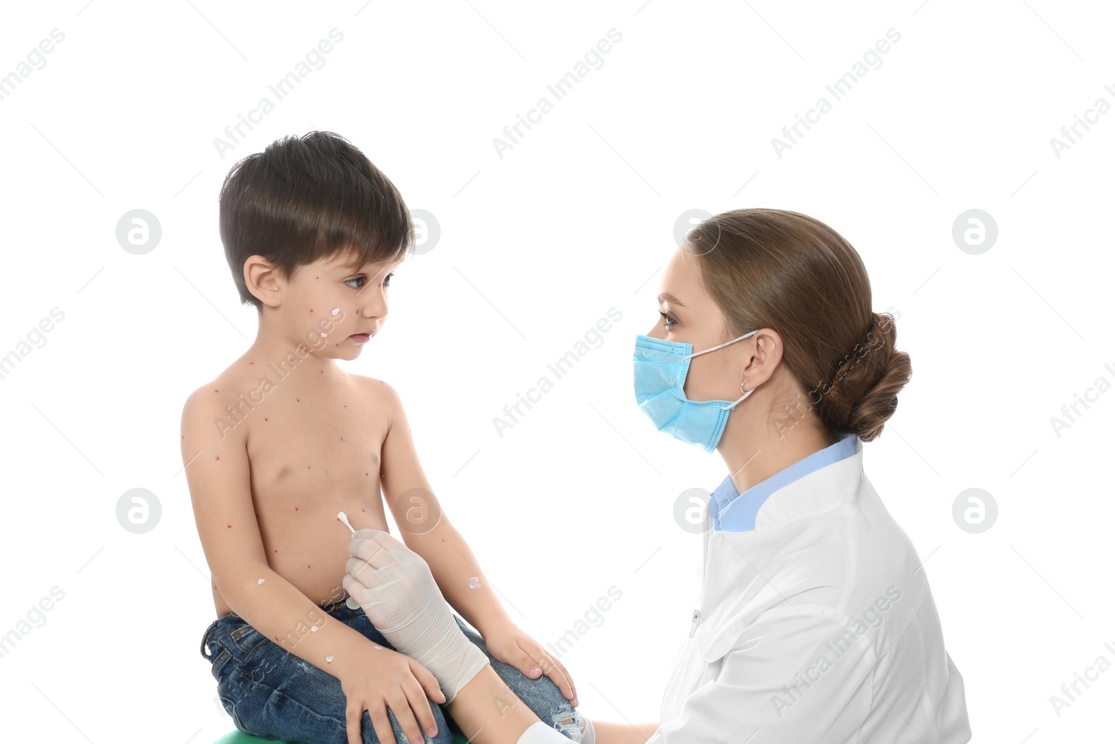 Photo of Doctor applying cream onto skin of little boy with chickenpox against white background. Varicella zoster virus