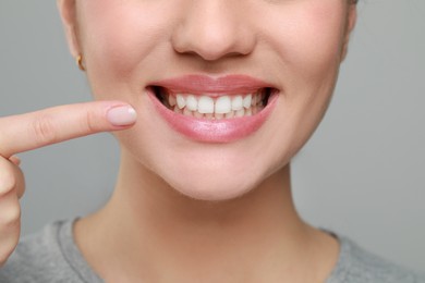 Photo of Woman showing healthy gums on grey background, closeup