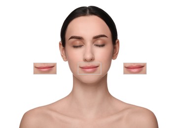 Attractive woman with beautiful lips on white background. Zoomed areas showing difference in lip fullness due to cosmetic procedure