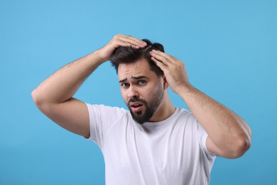 Photo of Emotional man examining his head on light blue background. Dandruff problem