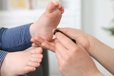 Photo of Mother applying essential oil from roller bottle onto her baby`s heel on blurred background, closeup