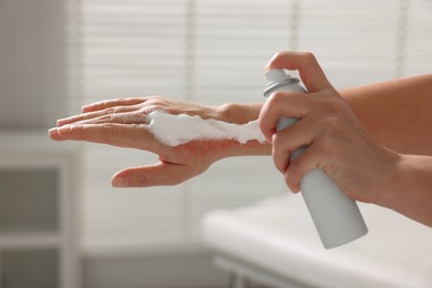 Photo of Woman applying panthenol onto burned hand indoors, closeup