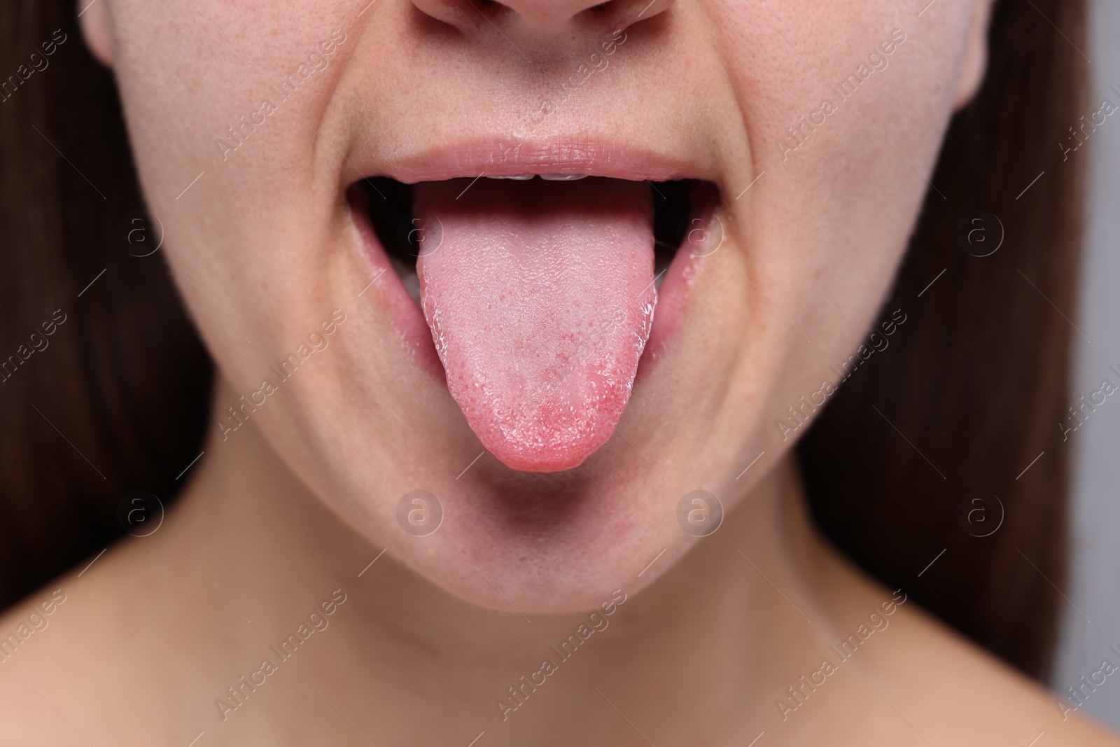 Photo of Closeup view of woman showing her tongue