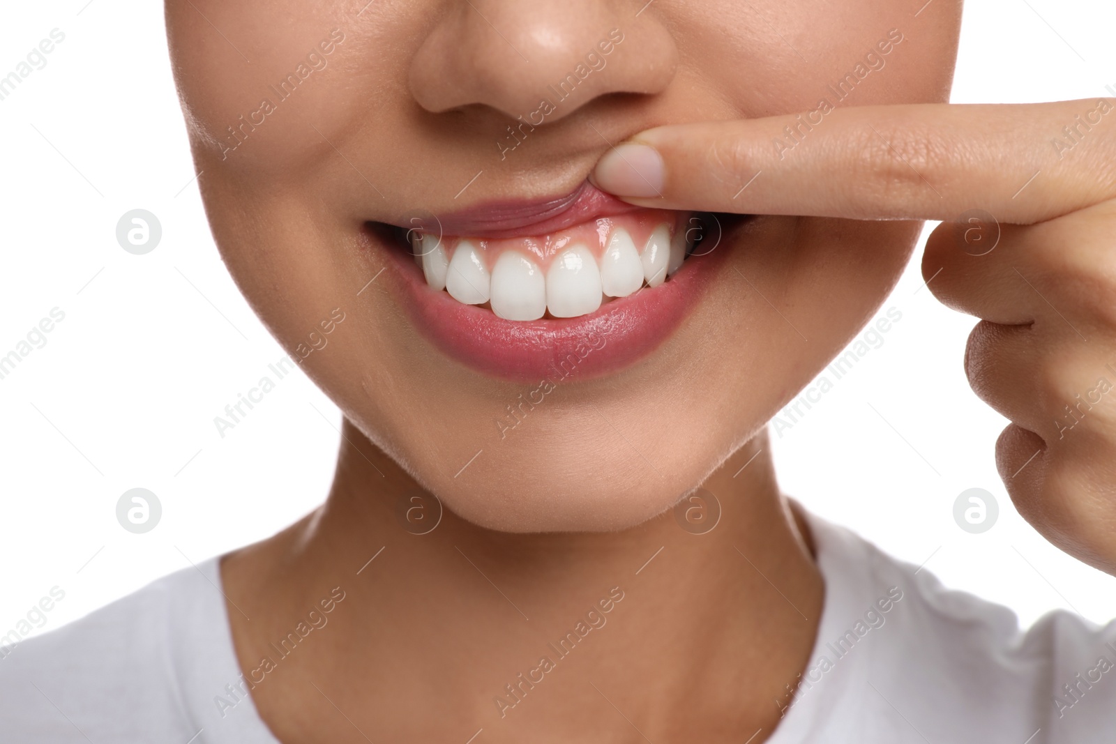 Photo of Young woman with healthy teeth on white background, closeup