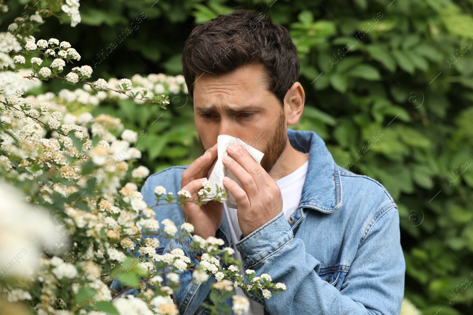 Photo of Man suffering from seasonal pollen allergy near blossoming tree on spring day