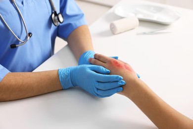 Photo of Doctor examining patient's burned hand at table, closeup