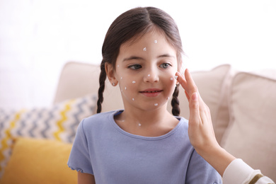 Photo of Mother applying cream onto skin of her daughter with chickenpox at home