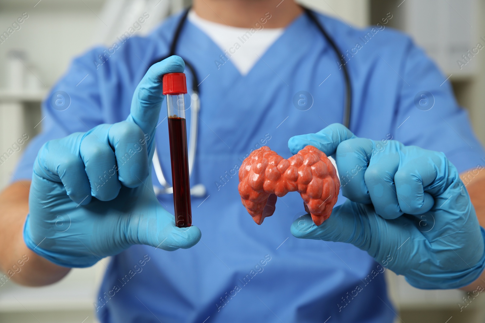 Photo of Endocrinologist showing thyroid gland model and blood sample in hospital, closeup