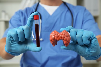 Photo of Endocrinologist showing thyroid gland model and blood sample in hospital, closeup