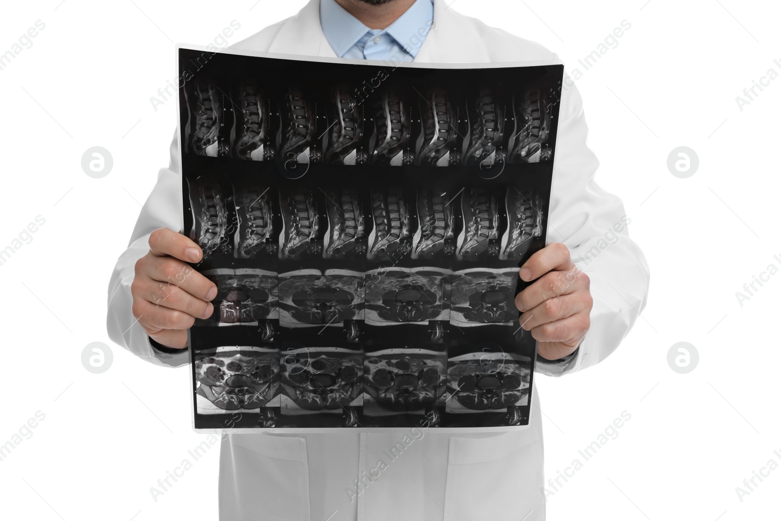 Photo of Orthopedist holding X-ray picture on white background, closeup