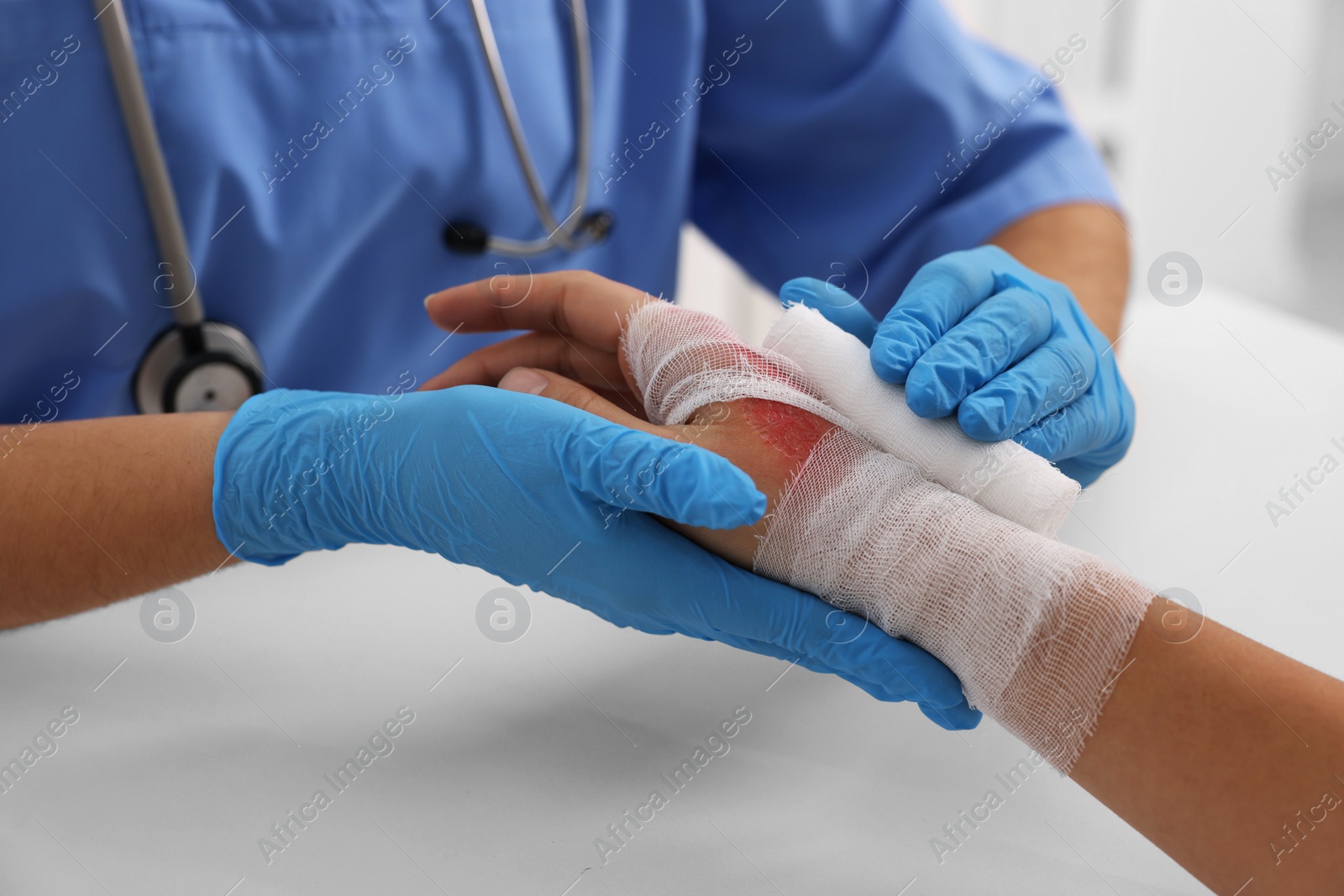 Photo of Doctor bandaging patient's burned hand at table, closeup