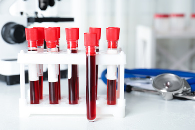 Photo of Test tubes with blood samples on table in laboratory. Virus research