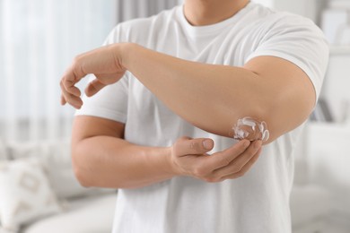 Man applying body cream onto his elbow at home, closeup