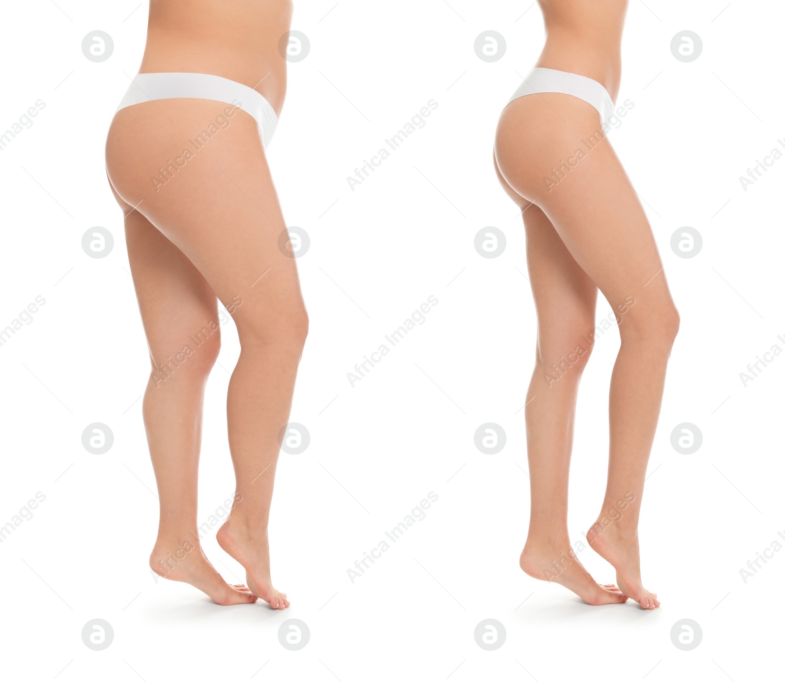 Image of Collage with photos of woman before and after weight loss diet on white background 