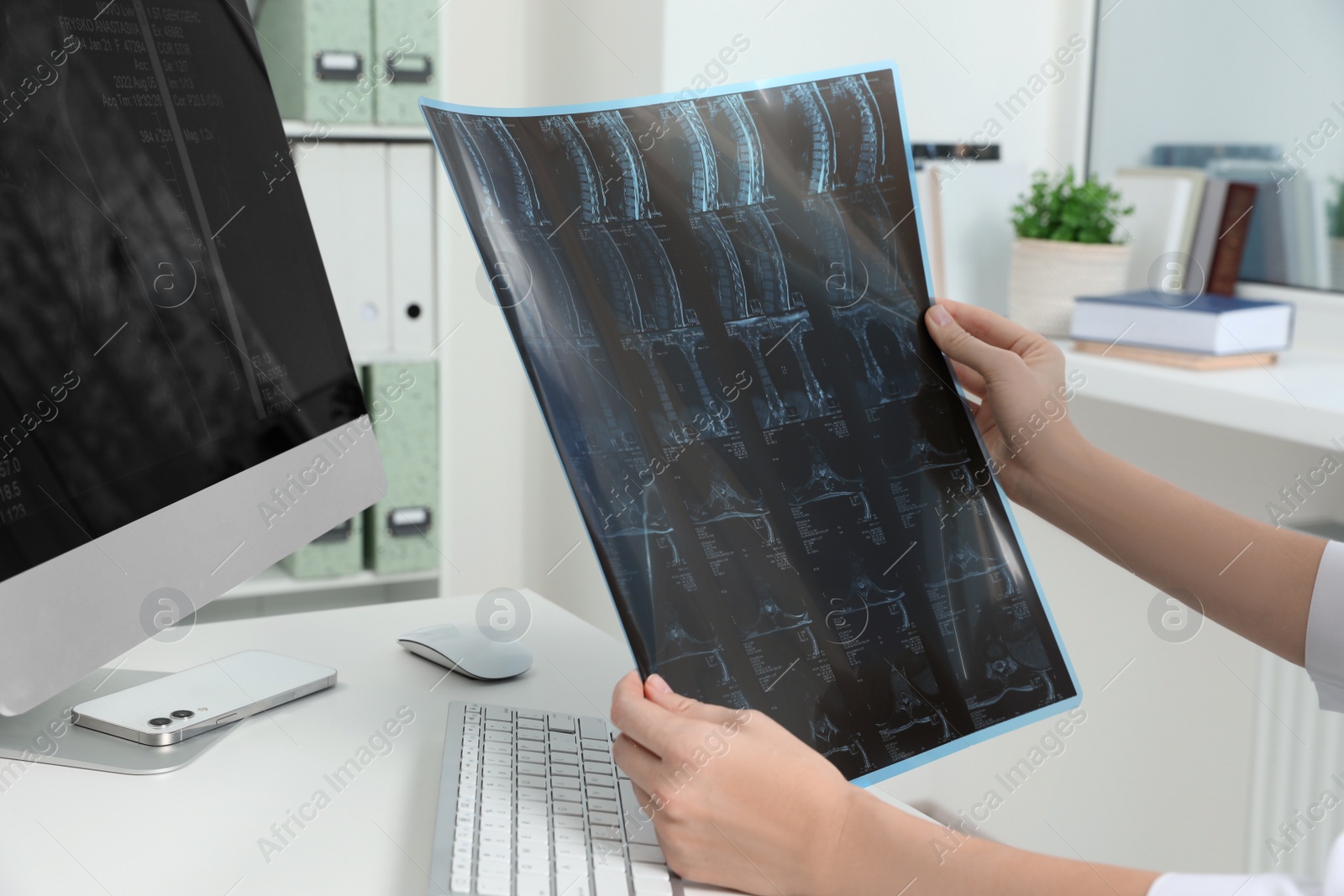 Photo of Doctor examining neck MRI image in clinic, closeup