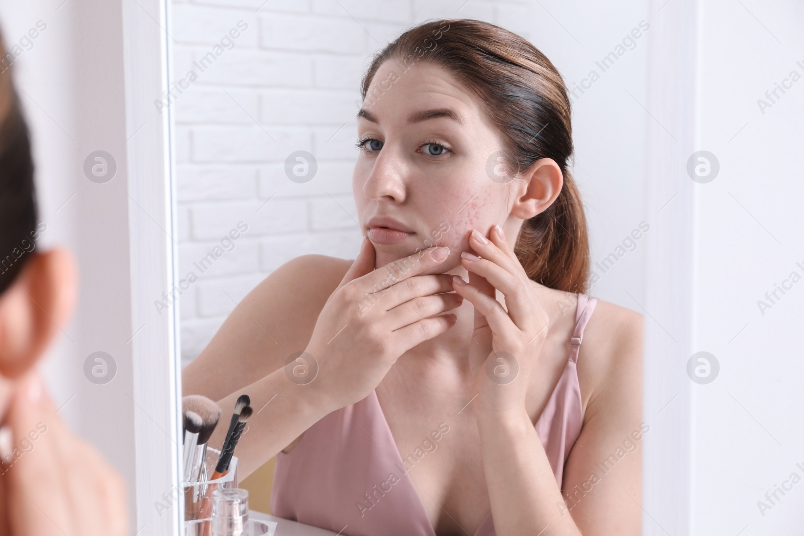 Photo of Woman with acne problem near mirror indoors