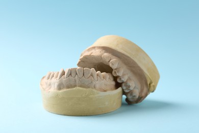 Photo of Dental model with gums on light blue background. Cast of teeth